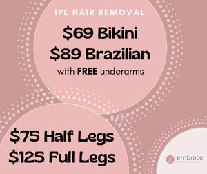 Up to 50% off IPL Hair Removal - Selected Areas